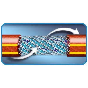 Mangueira 5 Camadas Nts 1/2" Antitorção Vermelha Pvc com Engates Rápidos e Esguicho 15m - Tramontina - Imagem 4